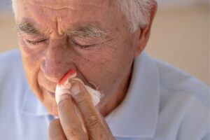 Senior mit Nasenbluten